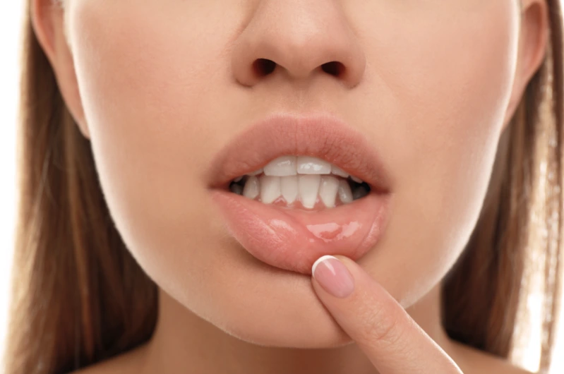 understanding the lip flip procedure