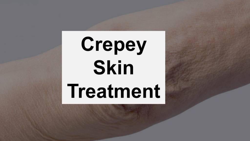 crepey skin Treatment