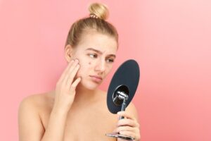 managing-your-acne-for-a-clearer-and-healthier-skin