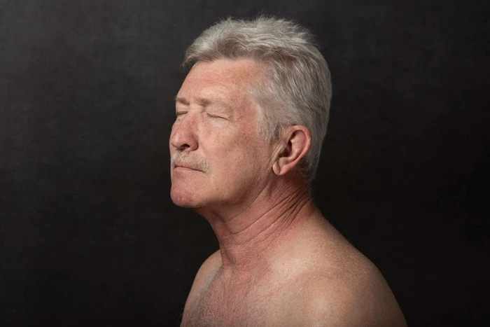 How to Get Rid of Neck Lines without Surgery
