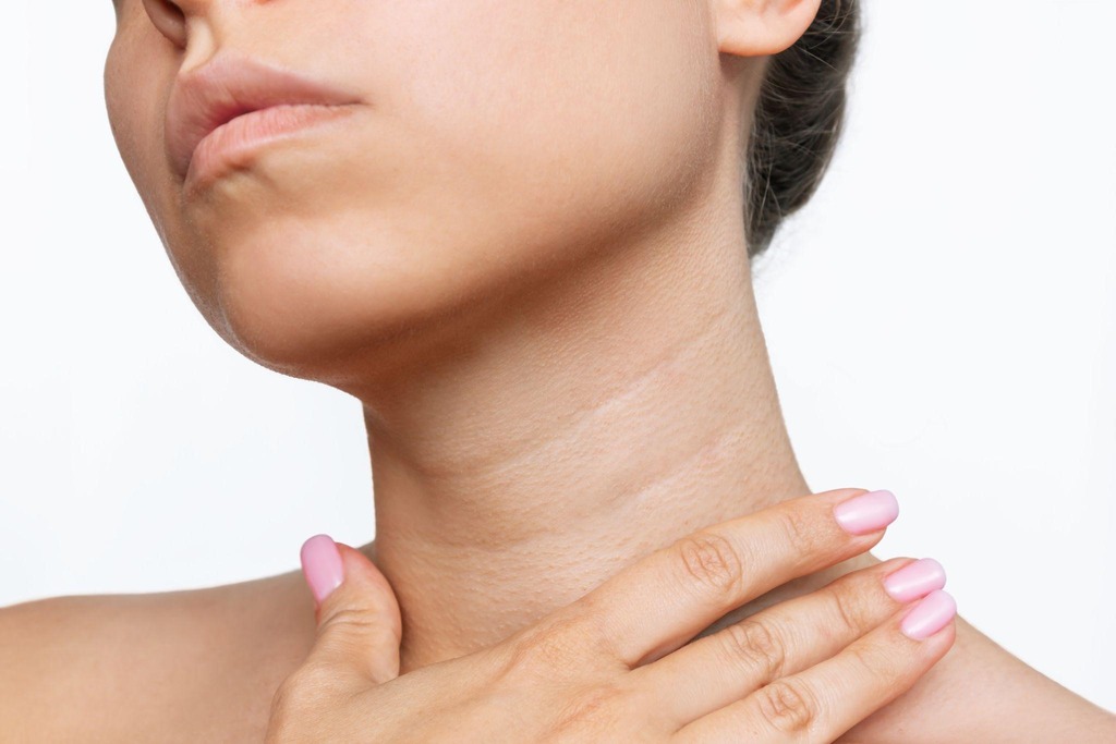 How To Get Rid Of Neck Wrinkles