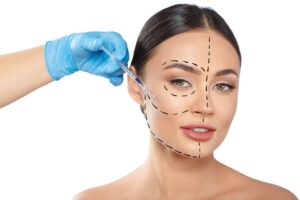 Marionette Lines Filler
