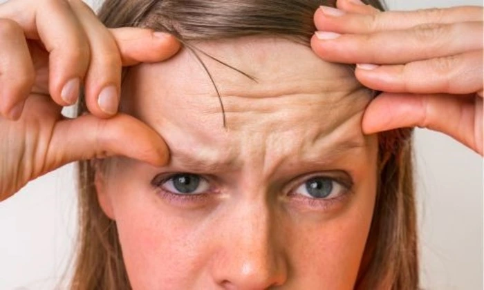 crow feet on eyes