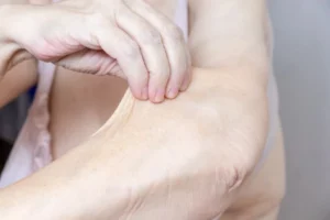 how to tighten loose skin after weight loss