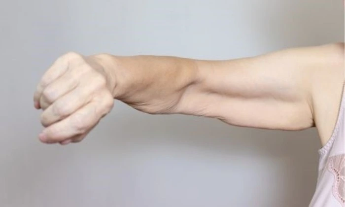 tighten loose skin