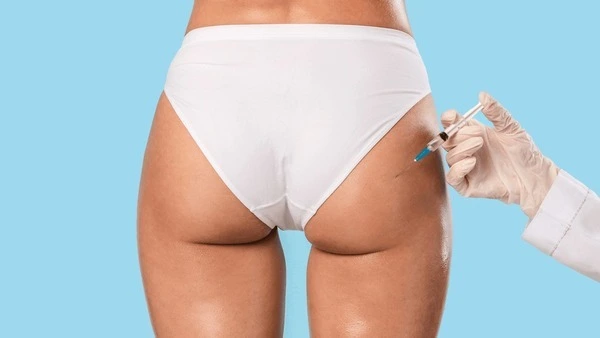 kybella treatment