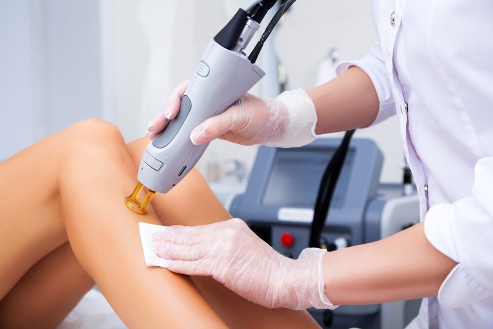 laser treatment legs hairs removal procedure
