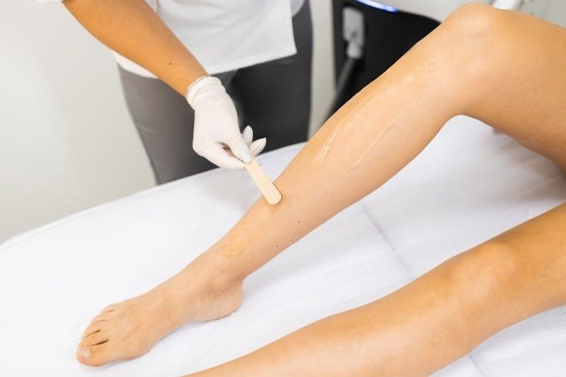 preparing for your laser removal leg hair session