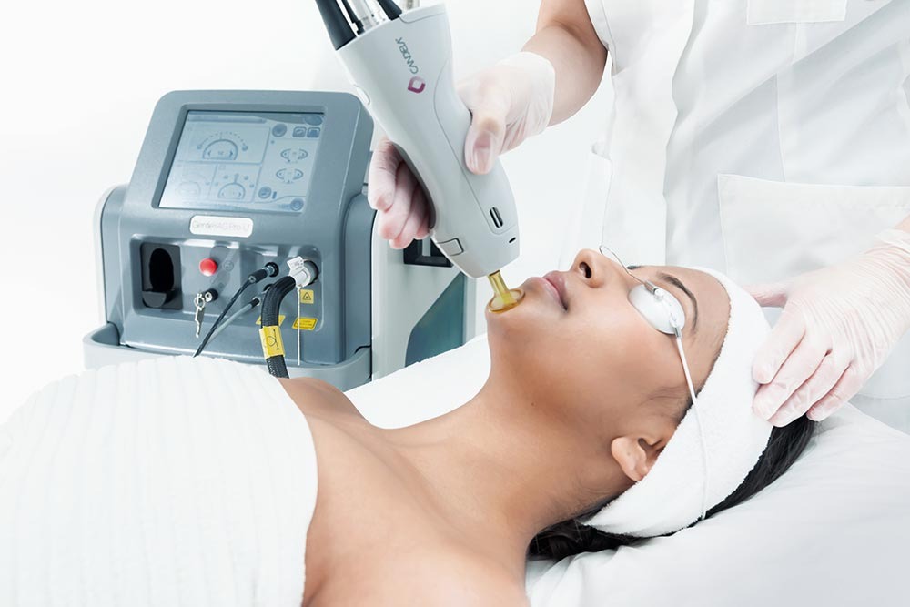 treatment process of laser hairs removal facial hair