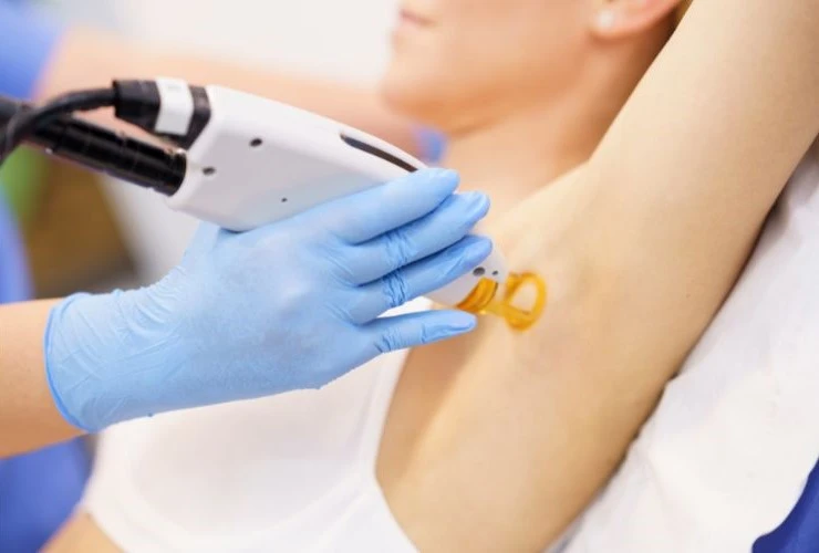 men and women laser hair removal