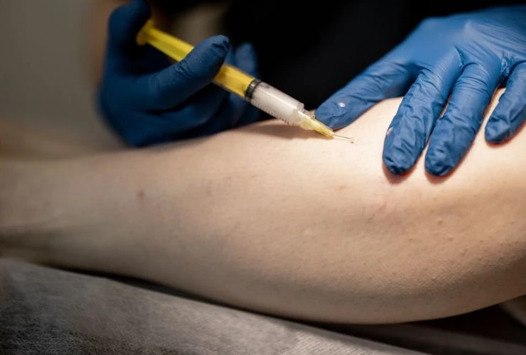 what is sclerotherapy
