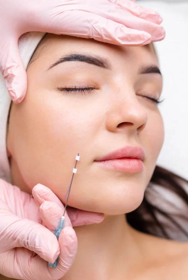 thread lift in los angeles