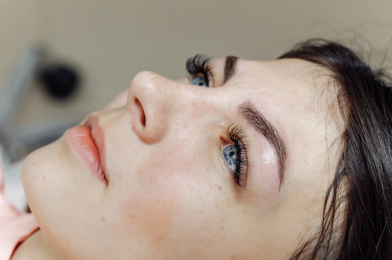 laser eyebrow tattoo removal before and after
