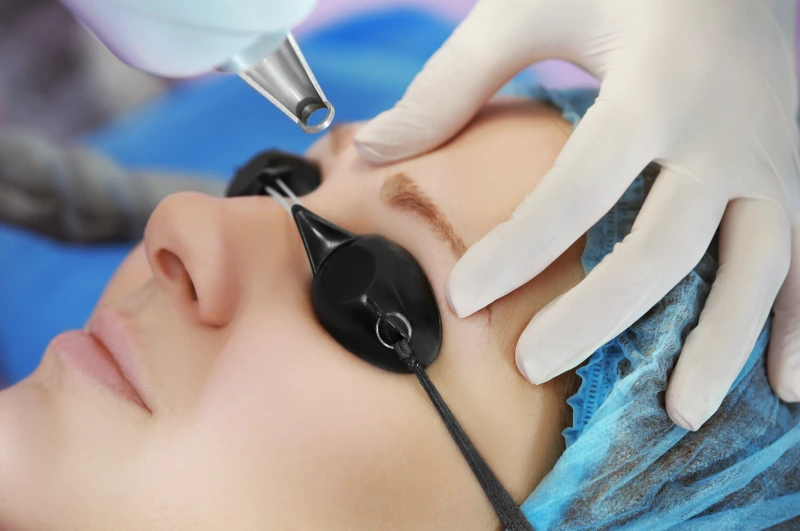 preparing eyebrow tattoo removal
