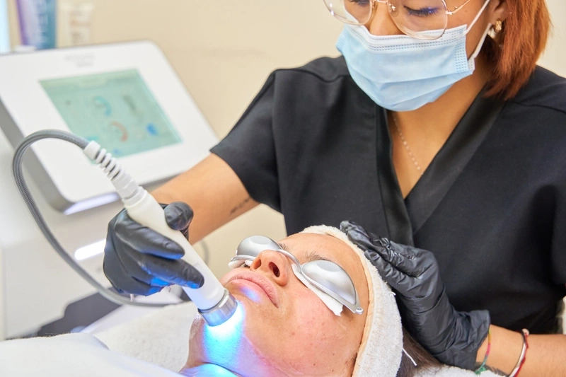 laser skin resurfacing