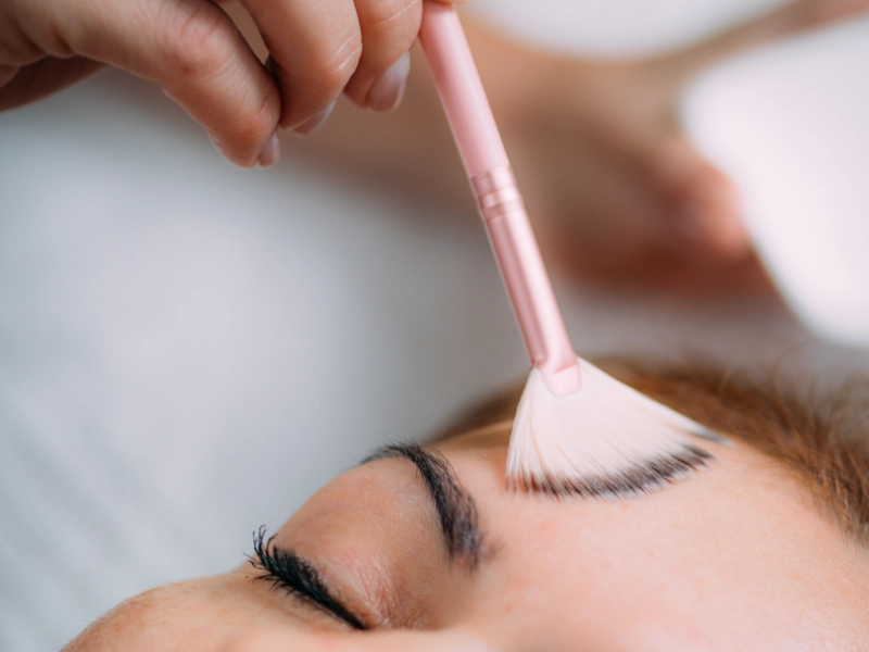what is a vi peel