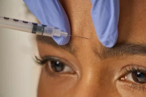 Juvederm