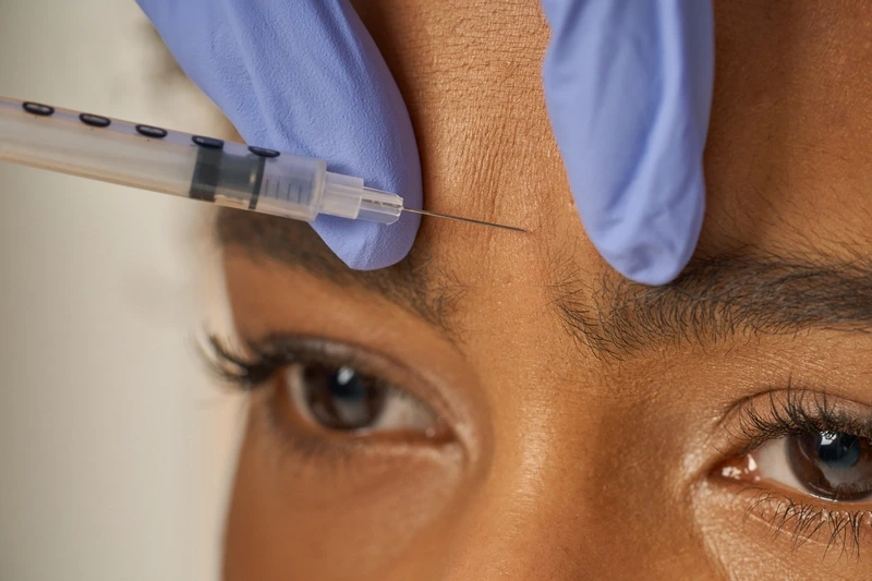 Juvederm