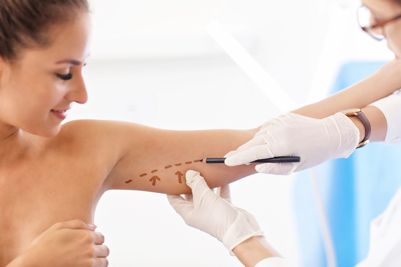arm fat injections​ result