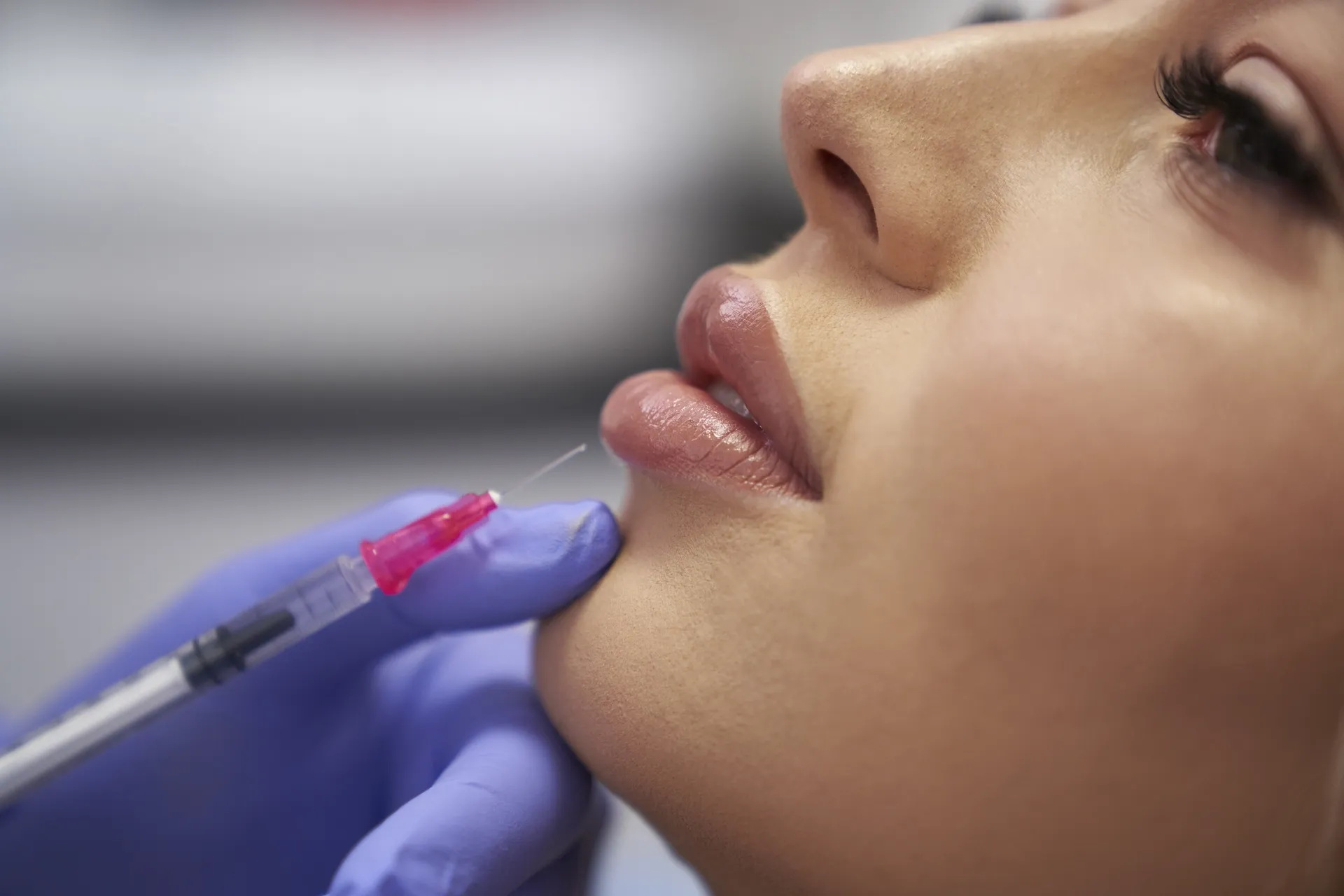 juvederm los angeles c