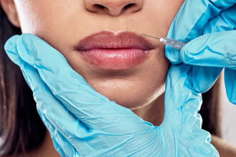 botox