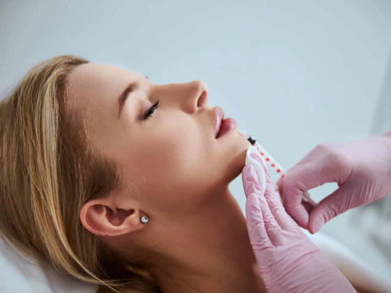 Dermal Fillers in Redond