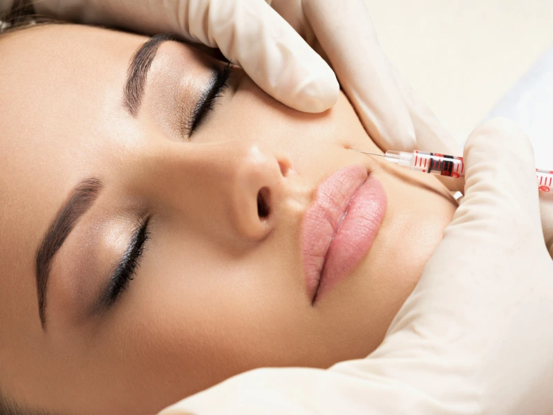 dermal fillers​ before and after