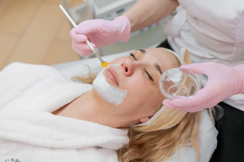 difference microneedling and chemical peel