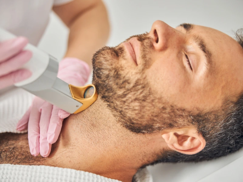 Laser Hair Removal Before and After