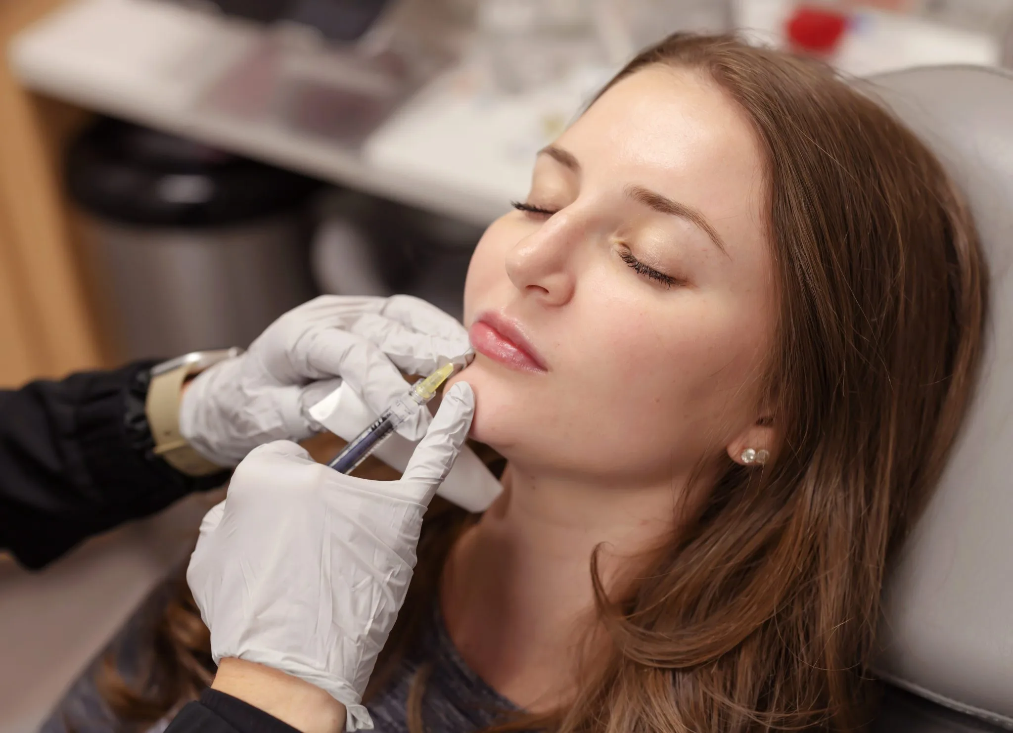 lip filler