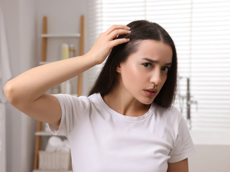 non-surgical hair loss before and after