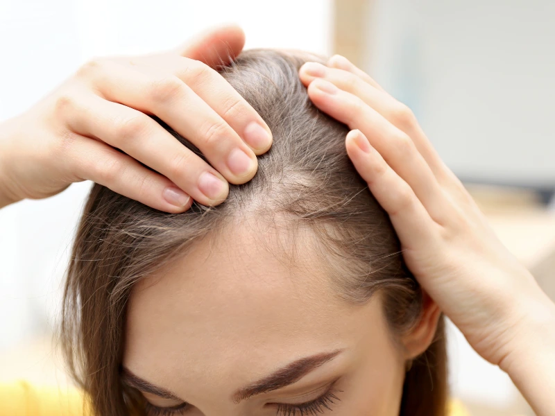 non-surgical hair loss treatment