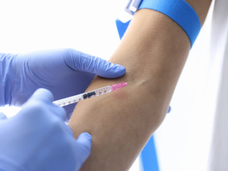 sclerotherapy before after​