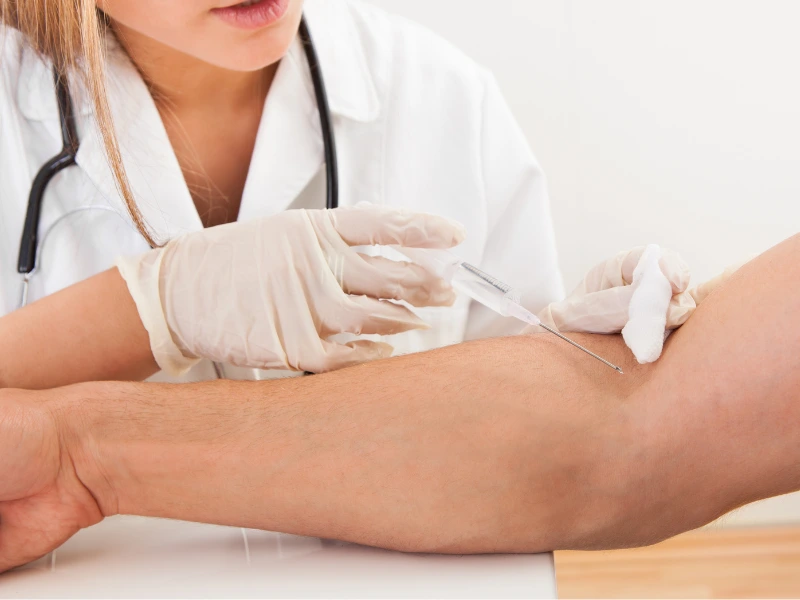 sclerotherapy redondo beach