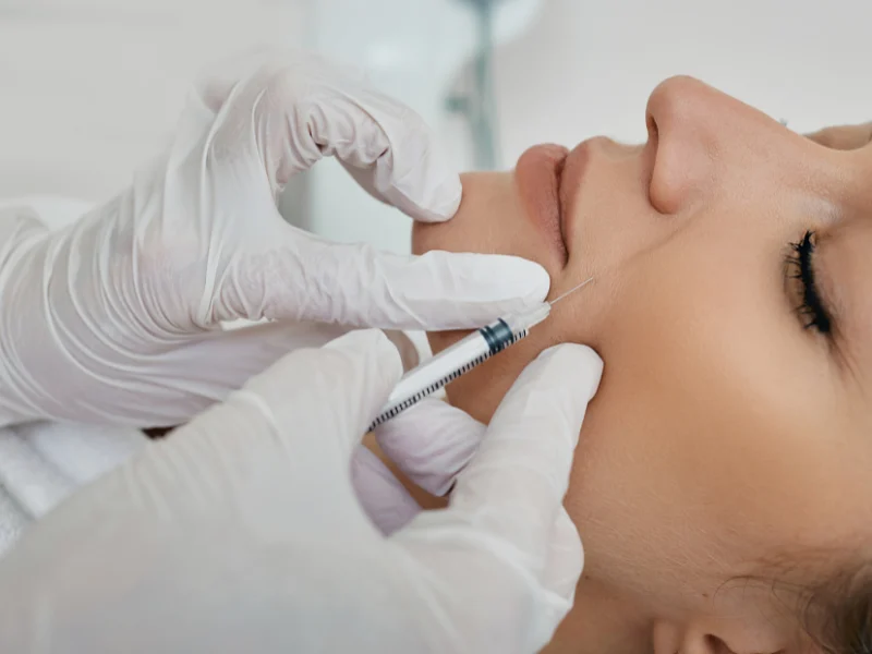 Smile Line Filler Options
