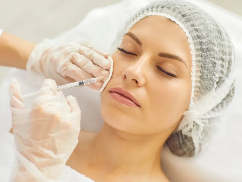 Smile Line Fillers