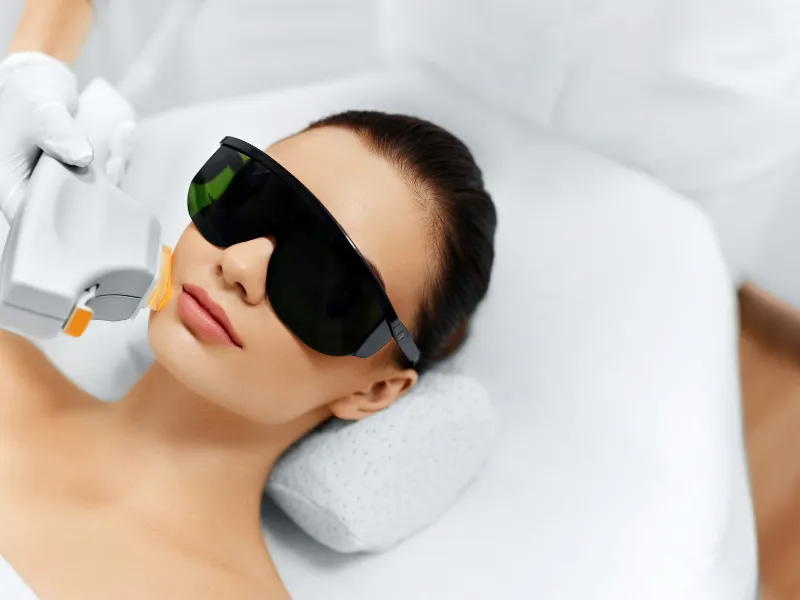 ipl photofacial in redondo beach