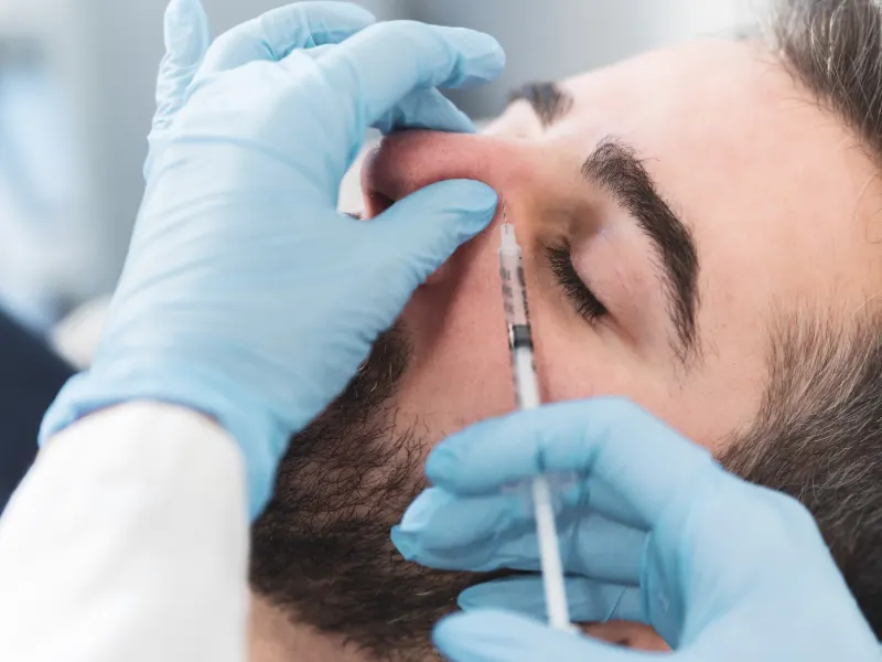non surgical nose filler treatment