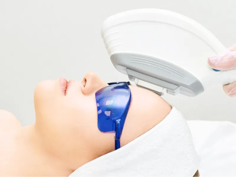 what is ipl photofacial
