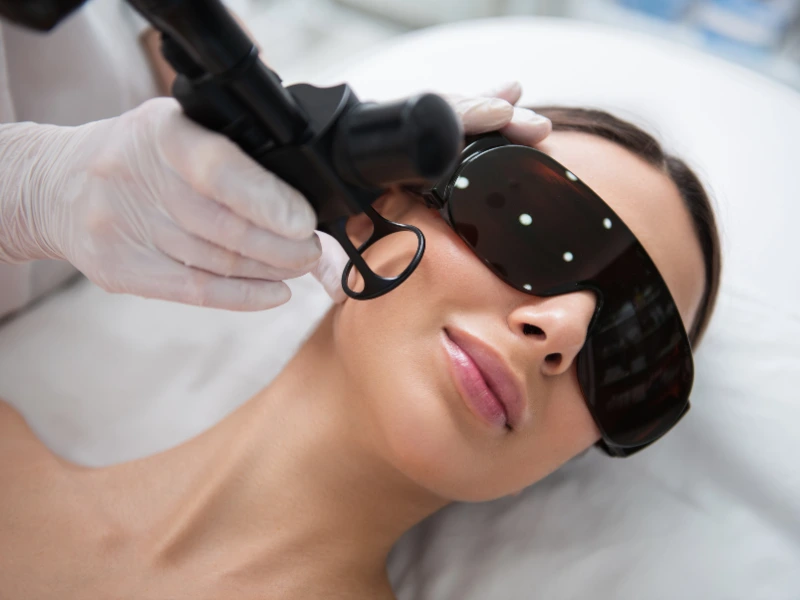 what is laser skin resurfacing