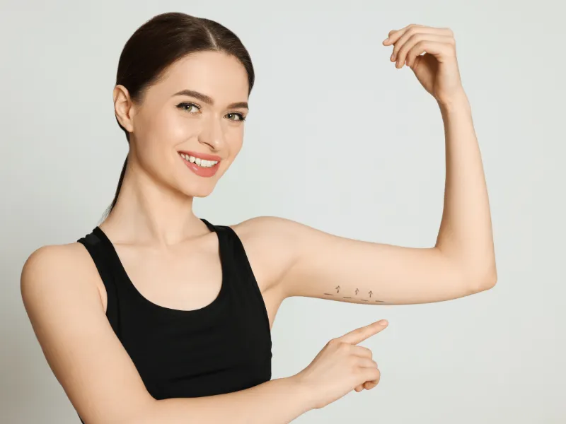 arm lift recovery time