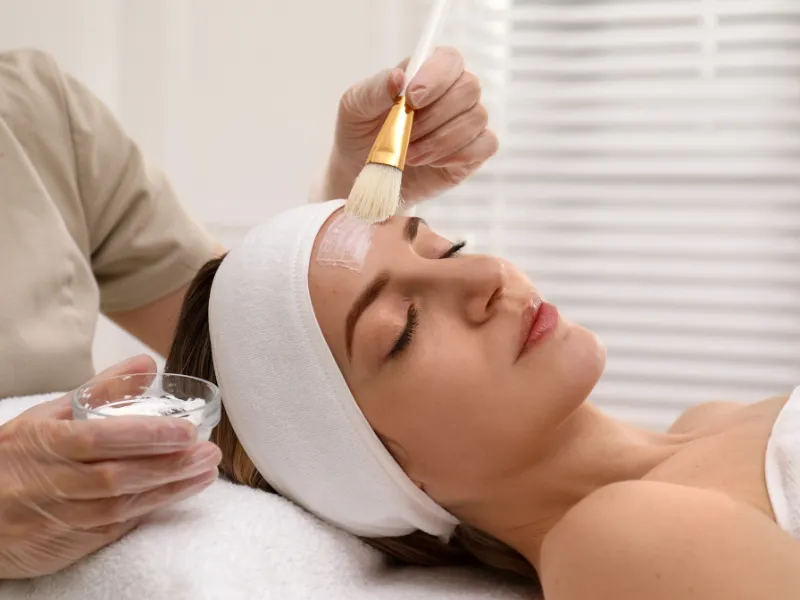 Chemical Peel