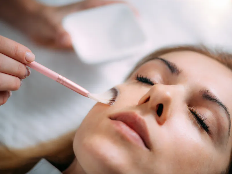 chemical peels aftercare