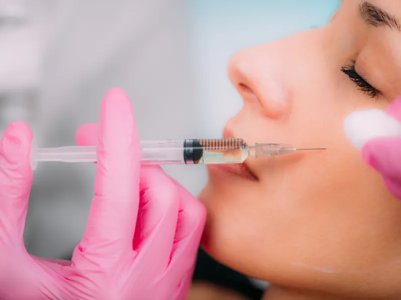 dermal fillers redondo beach
