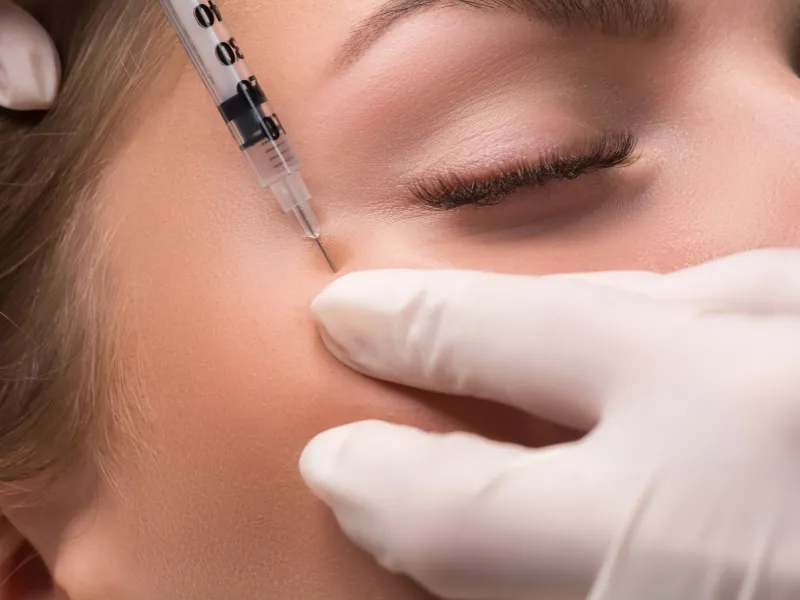 Eyelid Lift