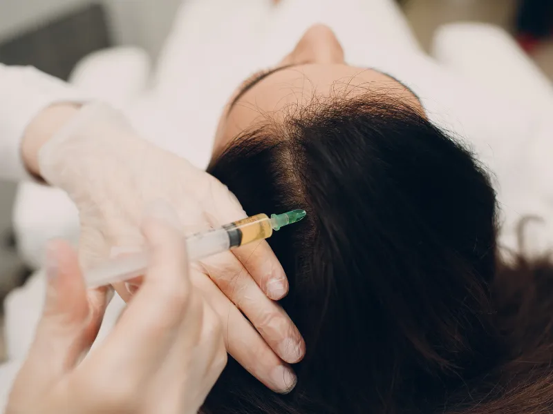 Hair Restoration Without Surgery