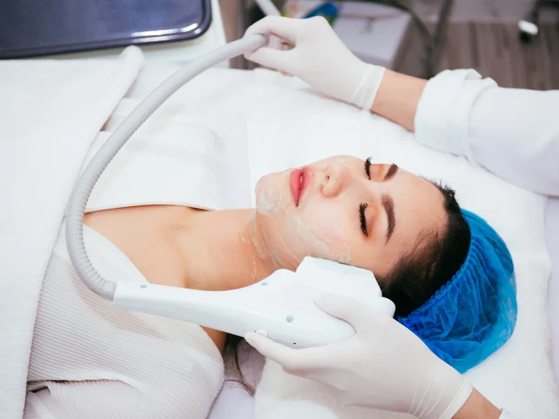 ipl photofacial machine
