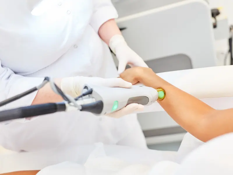 Laser Hair Removal