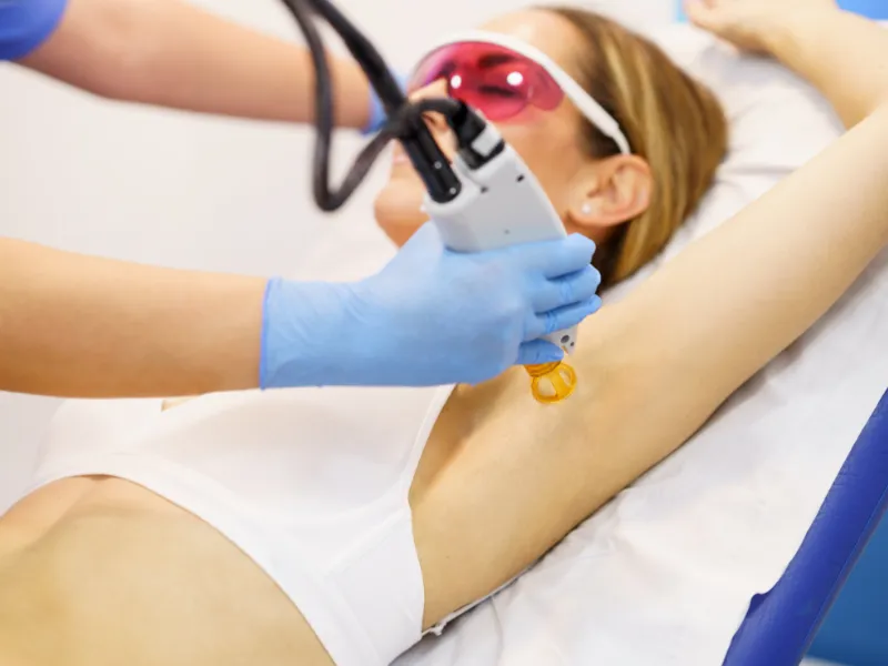 Laser Hair Removal