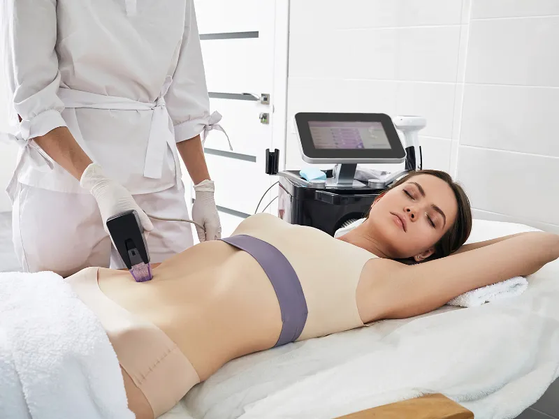 Morpheus8 Body Treatment